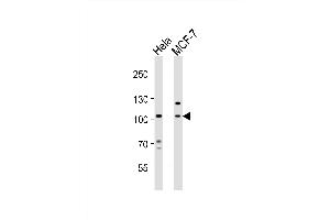 Western blot analysis of lysates from Hela, MCF-7 cell line (from left to right), using EPHA4 Antibody (Center) (ABIN6243787 and ABIN6577677). (EPH Receptor A4 抗体  (AA 417-451))