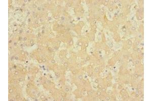 Immunohistochemistry of paraffin-embedded human liver tissue using ABIN7153109 at dilution of 1:100 (FTCD 抗体  (AA 412-541))