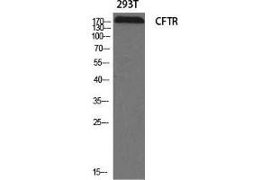 Western Blotting (WB) image for anti-Cystic Fibrosis Transmembrane Conductance Regulator (ATP-Binding Cassette Sub-Family C, Member 7) (CFTR) (Ser246) antibody (ABIN6284761)