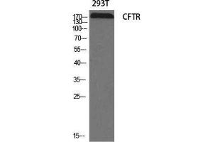 Western Blot (WB) analysis of specific cells using CFTR Polyclonal Antibody. (CFTR 抗体  (Ser246))