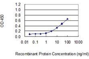 Detection limit for recombinant GST tagged DKC1 is 0. (DKC1 抗体  (AA 1-514))