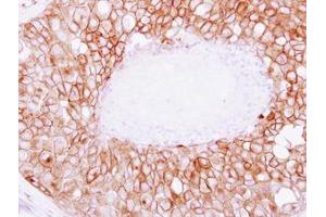 Image no. 1 for anti-Synaptosomal-Associated Protein, 23kDa (SNAP23) (AA 6-211) antibody (ABIN1501021) (SNAP23 抗体  (AA 6-211))