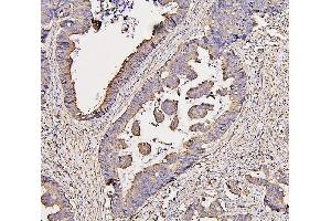 IHC analysis of COX IV using anti-COX IV antibody (ABIN7602090). (COX IV 抗体  (AA 59-169))