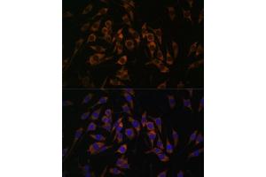 Immunofluorescence analysis of L929 cells using RPS13 antibody (ABIN7270012) at dilution of 1:100. (RPS13 抗体  (AA 79-151))