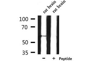 Western blot analysis of extracts from rat brain, using CHRM5 Antibody. (CHRM5 抗体  (C-Term))