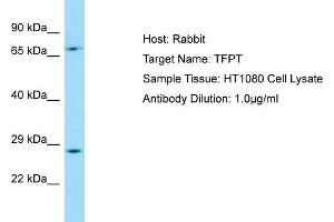 Host: RabbitTarget Name: TFPTAntibody Dilution: 1. (TFPT 抗体  (C-Term))