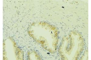 ABIN6273049 at 1/100 staining Mouse colon tissue by IHC-P.