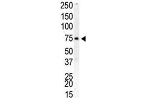 Western Blotting (WB) image for anti-Phosphatidylinositol-4-Phosphate 5-Kinase, Type I, beta (PIP5K1B) (AA 1-30) antibody (ABIN3032218)