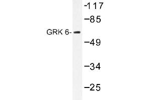 Image no. 1 for anti-G Protein-Coupled Receptor Kinase 6 (GRK6) antibody (ABIN272191) (GRK6 抗体)