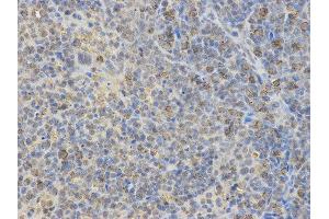 Immunohistochemistry (IHC) image for anti-Neural Wiskott-Aldrich syndrome protein (WASL) antibody (ABIN1875345) (Neural Wiskott-Aldrich syndrome protein (WASL) 抗体)
