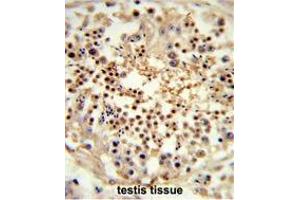 Formalin-fixed and paraffin-embedded human testis tissue reacted with RS18 Antibody (Center), which was peroxidase-conjugated to the secondary antibody, followed by DAB staining. (UNC119 抗体  (Middle Region))