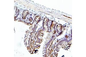 IHC analysis of EIF4A using anti-EIF4A antibody (ABIN7601309).