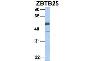 Host:  Rabbit  Target Name:  ZBTB25  Sample Type:  Human Fetal Heart  Antibody Dilution:  1. (ZBTB25 抗体  (Middle Region))