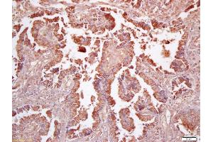Immunohistochemistry (IHC) image for anti-Formyl Peptide Receptor 1 (FPR1) antibody (ABIN742245)