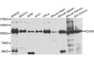 Western blot analysis of extracts of various cell lines, using FOXM1 antibody. (FOXM1 抗体)