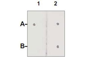 Dot Blot : 1 ug peptide was blot onto NC membrane. (Androgen Receptor 抗体  (pSer210))
