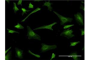 Immunofluorescence of monoclonal antibody to PLP1 on HeLa cell. (PLP1 抗体  (AA 177-232))