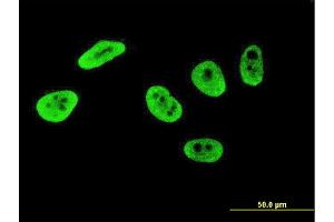 Immunofluorescence of monoclonal antibody to CRKRS on HeLa cell. (CDK12 抗体  (AA 1281-1380))