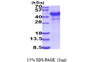 SDS-PAGE (SDS) image for ST6 beta-Galactosamide alpha-2,6-Sialyltranferase 1 (ST6GAL1) (AA 27-406) protein (His tag) (ABIN5854168) (ST6GAL1 Protein (AA 27-406) (His tag))