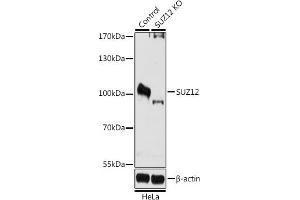 Western blot analysis of extracts from normal (control) and SUZ12 knockout (KO) HeLa cells, using SUZ12 antibody (ABIN6127300, ABIN6148752, ABIN6148754 and ABIN7101816) at 1:1000 dilution. (SUZ12 抗体  (AA 470-739))