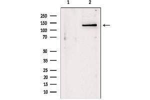 Western blot analysis of extracts from Mouse myeloma, using DHX9 antibody. (DHX9 抗体  (C-Term))