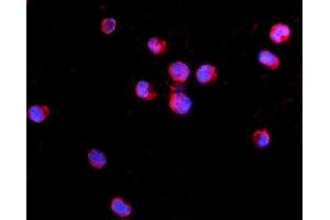 IF analysis of IL2 Receptor gamma/IL2RG using anti-IL2 Receptor gamma/IL2RG antibody (ABIN7603175). (IL2RG 抗体  (N-Term))