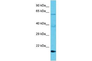 Host: Rabbit Target Name: TMBIM1 Sample Type: Jurkat Whole Cell lysates Antibody Dilution: 1. (TMBIM1 抗体  (N-Term))