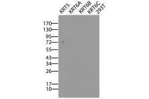Image no. 2 for anti-Keratin 5 (KRT5) (AA 1-273) antibody (ABIN1490697) (Cytokeratin 5 抗体  (AA 1-273))