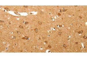 Immunohistochemistry of paraffin-embedded Human brain tissue using MAP1B Polyclonal Antibody at dilution 1:60 (MAP1B 抗体)