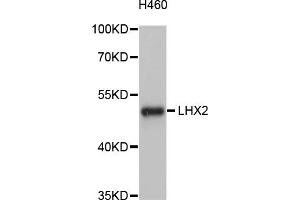 Western blot analysis of extracts of H460 cells, using LHX2 antibody (ABIN4904227) at 1:1000 dilution. (LHX2 抗体)