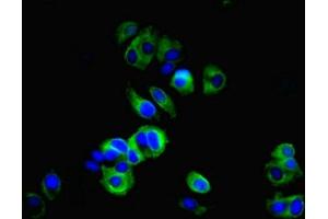 Immunofluorescent analysis of MCF-7 cells using ABIN7148290 at dilution of 1:100 and Alexa Fluor 488-congugated AffiniPure Goat Anti-Rabbit IgG(H+L) (TMEM27 抗体  (AA 15-141))
