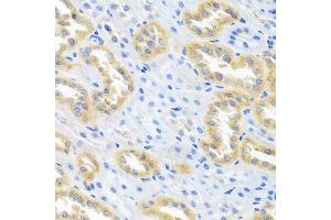 Immunohistochemistry (Paraffin-embedded Sections) (IHC (p)) image for anti-Bone Morphogenetic Protein 3 (BMP3) (AA 243-472) antibody (ABIN6137597)