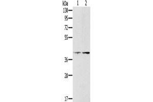 Gel: 8 % SDS-PAGE, Lysate: 40 μg, Lane 1-2: Hela cells, lovo cells, Primary antibody: ABIN7130569(PDGFRL Antibody) at dilution 1/400, Secondary antibody: Goat anti rabbit IgG at 1/8000 dilution, Exposure time: 10 minutes (PDGFRL 抗体)
