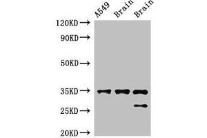 Western Blot Positive WB detected in: A549 whole cell lysate, Rat brain tissue, Mouse brain tissue All lanes: STUB1 antibody at 2 μg/mL Secondary Goat polyclonal to rabbit IgG at 1/50000 dilution Predicted band size: 35, 28 kDa Observed band size: 35, 28 kDa (STUB1 抗体  (AA 1-48))