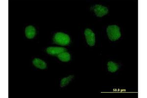 Immunofluorescence of purified MaxPab antibody to PB1 on HeLa cell. (Polybromo 1 抗体  (AA 1-306))