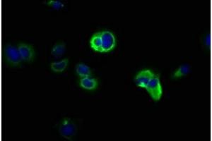 Immunofluorescence staining of MCF-7 cells with ABIN7169039 at 1:166, counter-stained with DAPI. (DCLK1 抗体  (AA 143-381))