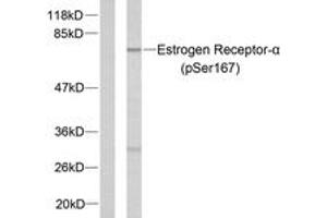 Western blot analysis of extracts from MCF7 cells treated with EGF, using Estrogen Receptor-alpha (Phospho-Ser167) Antibody. (Estrogen Receptor alpha 抗体  (pSer167))