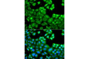Immunofluorescence analysis of A549 cells using NLRC4 antibody (ABIN5975127).