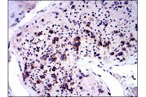 Immunohistochemical analysis of paraffin-embedded testis tissues using NQO1 mouse mAb with DAB staining. (NQO1 抗体)