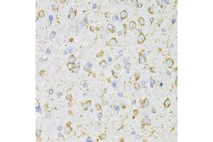 Immunohistochemistry of paraffin-embedded rat brain using LRP Antibody (ABIN3017160, ABIN3017161, ABIN1680715 and ABIN6219979) at dilution of 1:200 (40x lens). (LRPAP1 抗体)