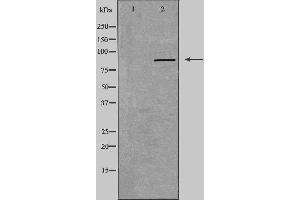 Western blot analysis of extracts from Jurkat cells, using RXFP2 antibody.