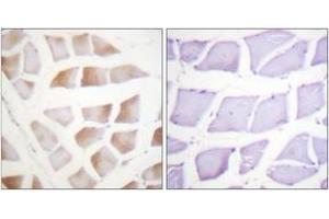 Immunohistochemistry analysis of paraffin-embedded human skeletal muscle tissue, using CRYAB (Ab-59) Antibody. (CRYAB 抗体  (AA 31-80))