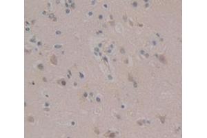IHC-P analysis of Human Tissue, with DAB staining. (AXIN2 抗体  (AA 350-631))