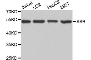 Western blot analysis of extracts of various cell lines, using SSB antibody (ABIN1874948) at 1:1000 dilution. (SSB 抗体)