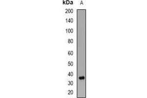 Western blot analysis of PPP2CB expression in Jurkat (A) whole cell lysates. (PPP2CB 抗体)