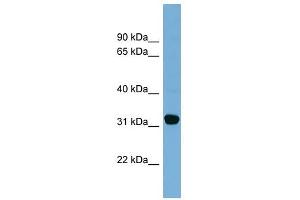 Carbonyl Reductase 1 antibody used at 1 ug/ml to detect target protein. (CBR1 抗体  (Middle Region))