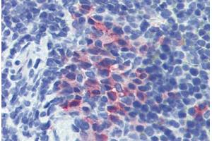 Mouse spleen: Formalin-Fixed, Paraffin-Embedded (FFPE) (CD11b 抗体)