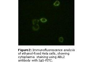 Image no. 2 for anti-ABL2 (ABL2) antibody (ABIN230671) (ABL2 抗体)