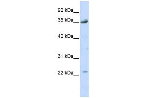 WB Suggested Anti-P2RX2 Antibody Titration:  0. (P2RX2 抗体  (Middle Region))