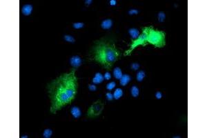 Immunofluorescence (IF) image for anti-Proteasome (Prosome, Macropain) 26S Subunit, Non-ATPase, 2 (PSMD2) antibody (ABIN1500481) (PSMD2 抗体)
